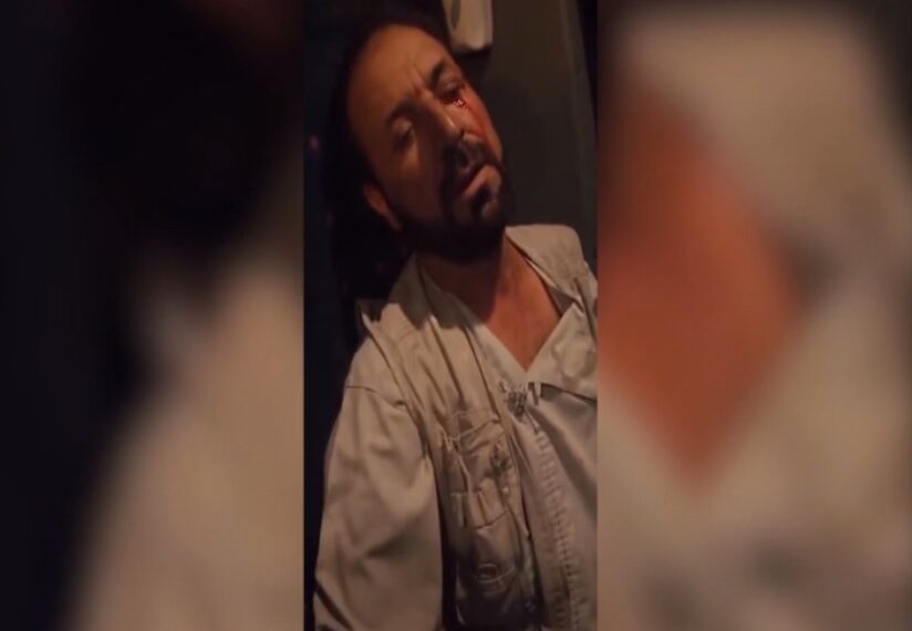 د یوه بس چلوونکي ادعا؛ امنیتي ځواکونو مې سترګه ړنده کړه