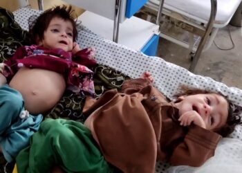 یونېسف: درې میلیونه افغان ماشومان له شدیدې خوارځواکۍ سره مخ دي