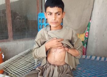 له جګړو پاتې شوي ناچاوده توکي لاهم د افغانانو ژوند ګواښي