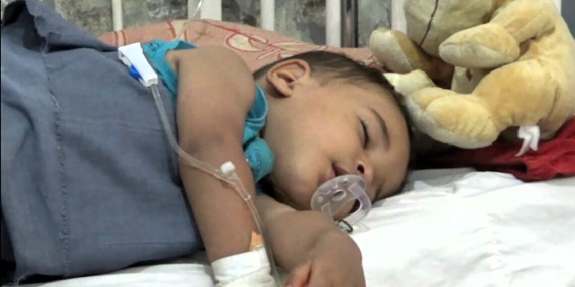 بې پولې ډاکټران؛ په هرات کې د شري ناروغۍ پېښې زیاتې شوې