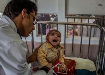 یونیسف د خوارځواکو ماشومانو تشخیص لپاره یو میلیون ماشومان معاینه کړي