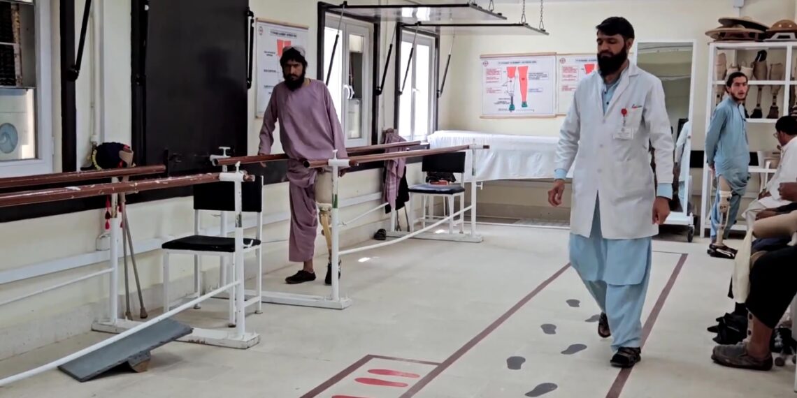 سور صلیب: تېرکال مو ۳۴ زره تنو ته مصنوعي غړي جوړ کړي