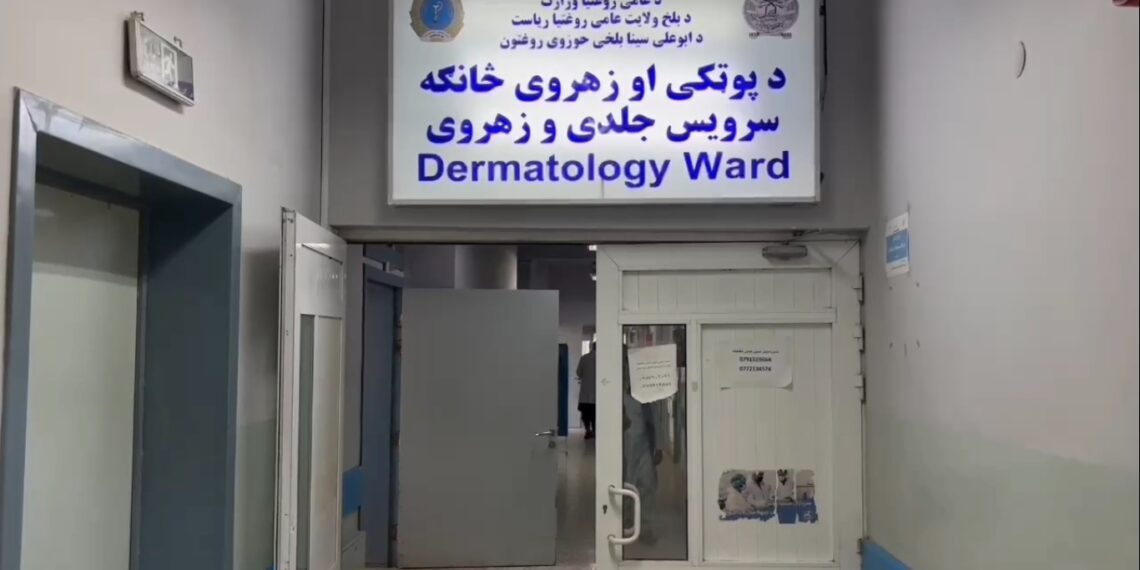 بلخ کې په جلدي ناروغیو د اخته کسانو شمېر زیات شوی