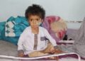 ملګرو ملتونه: افغانستان کې شاوخوا ۵ میلیونه ماشومان له شدیدې خوارځواکۍ سره مخ دي