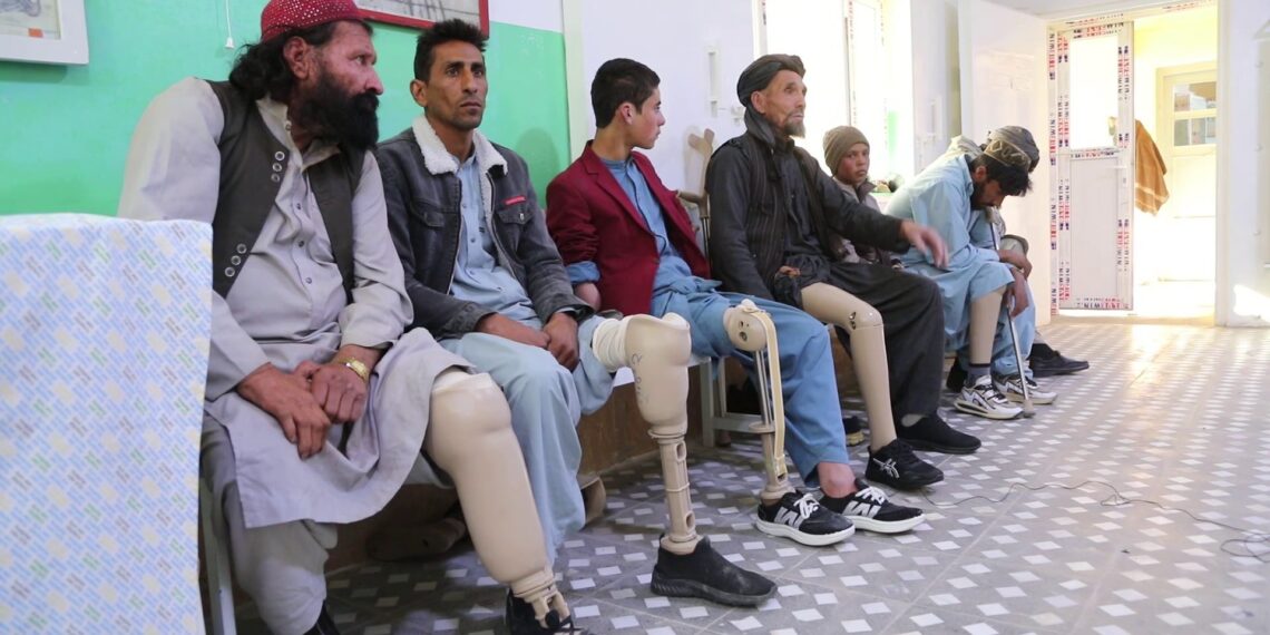 هرات کې د سره صلیب اورتپیدي څانګه هره ورځ ۲۰ تنو ته خدمات وړاندې کوي