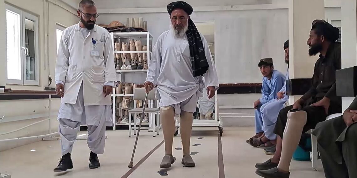 تېر کال هلمند کې ۴۳۶ تنو ته مصنوعي غړي لګول شوي