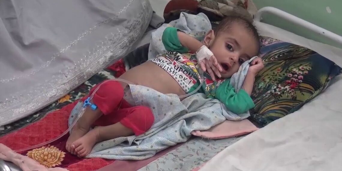 ملګري ملتونه: ميلیونونه افغان میندې او ماشومان د خوارځواکۍ له خطر سره مخ دي