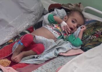 ملګري ملتونه: ميلیونونه افغان میندې او ماشومان د خوارځواکۍ له خطر سره مخ دي