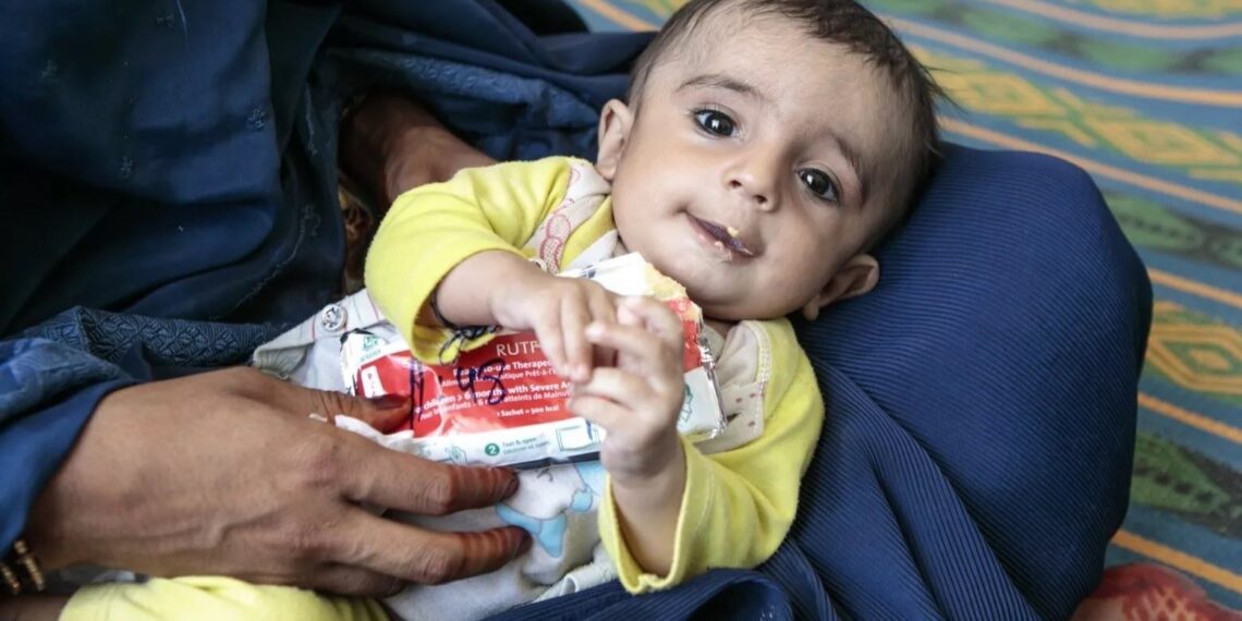 ملګري ملتونه: افغانستان کې د ماشومانو خوارځواکۍ بحران مخ په زیاتېدو دی
