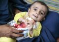 ملګري ملتونه: افغانستان کې د ماشومانو خوارځواکۍ بحران مخ په زیاتېدو دی