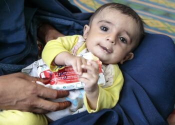 ملګري ملتونه: افغانستان کې د ماشومانو خوارځواکۍ بحران مخ په زیاتېدو دی
